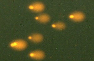 Células de hepatoma humano tratadas con N-itrosopirrolidina